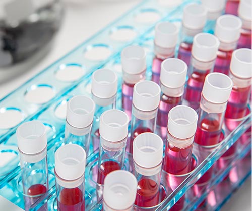 Применение фторопласта